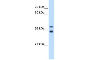WB Suggested Anti-GDE1 Antibody Titration:  0. (GDE1 antibody  (N-Term))