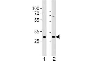 Western blot analysis of lysate from (1) SH-SY5Y and (2) MCF-7 cell line using HES1 antibody at 1:1000. (HES1 antibody  (C-Term))