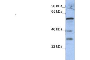 WB Suggested Anti-GADL1  Antibody Titration: 0. (GADL1 antibody  (Middle Region))