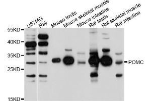 Western blot analysis of extracts of various cells, using POMC antibody. (POMC antibody)