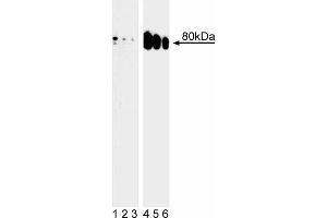 Western blot analysis of Ezrin (pT567) in human epidermis. (Ezrin antibody  (pThr567))