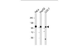 All lanes : Anti-MET/HGFR Antibody at dilution Lane 1: HeLa whole cell lysate Lane 2: HepG2 whole cell lysate Lane 3: COS-7 whole cell lysate Lysates/proteins at 20 μg per lane. (c-MET antibody  (Catalytic Domain))
