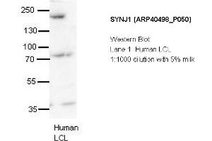 Image no. 2 for anti-Synaptojanin 1 (SYNJ1) (N-Term) antibody (ABIN2778875) (Synaptojanin 1 antibody  (N-Term))
