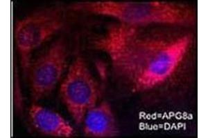 Immunofluorescent staining of Mouse brain cells using LC3 (MAP1LC3A antibody  (N-Term))