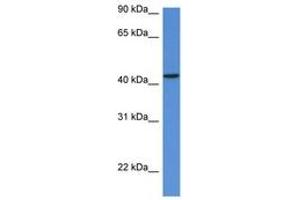 Image no. 1 for anti-Mevalonate (Diphospho) Decarboxylase (MVD) (AA 74-123) antibody (ABIN6746938) (MVD antibody  (AA 74-123))