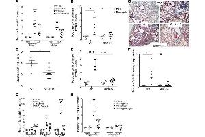 Immunohistochemistry (IHC) image for anti-Collagen, Type I (COL1) antibody (ABIN5596819)