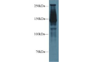 Western Blot; Sample: Rat Lung lysate; Primary Ab: 1µg/ml Rabbit Anti-Rat SPTAN1 Antibody Second Ab: 0. (SPTAN1 antibody  (AA 1004-1181))