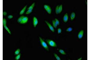 Immunofluorescent analysis of Hela cells using ABIN7142928 at dilution of 1:100 and Alexa Fluor 488-congugated AffiniPure Goat Anti-Rabbit IgG(H+L) (ABI2 antibody  (AA 164-452))