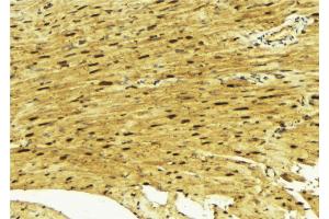 ABIN6269312 at 1/100 staining Mouse muscle tissue by IHC-P. (MEF2A antibody  (Internal Region))