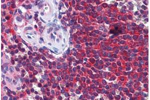 Human Spleen: Formalin-Fixed, Paraffin-Embedded (FFPE) (STIP1 antibody  (AA 445-544))