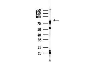 Western blot analysis of lysates from COLO205 cells(heat-shock,45 min treatment), using CNG Antibody at 1/1000 dilution.