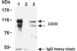 Western Blotting (WB) image for anti-Tumor Necrosis Factor Receptor Superfamily, Member 8 (TNFRSF8) antibody (ABIN492585) (TNFRSF8 antibody)