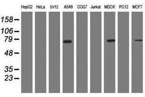 Image no. 2 for anti-Receptor (TNFRSF)-Interacting serine-threonine Kinase 1 (RIPK1) (AA 133-422) antibody (ABIN1490913) (RIPK1 antibody  (AA 133-422))