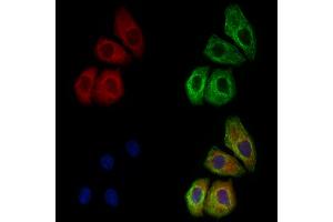ABIN6259594 and ABIN6274739 staining Hela cells by IF/ICC. (MRPL35 antibody  (Internal Region))