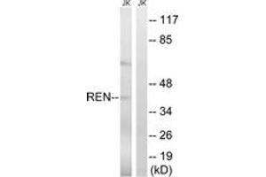 Western blot analysis of extracts from Jurkat cells, using REN Antibody. (Renin antibody  (AA 207-256))