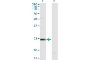 Western Blot analysis of RAB7B expression in transfected 293T cell line by RAB7B monoclonal antibody (M02), clone 1C3. (RAB7B antibody  (AA 100-199))