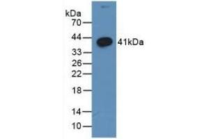 Detection of Recombinant WNT3A, Human using Monoclonal Antibody to Wingless Type MMTV Integration Site Family, Member 3A (WNT3A) (WNT3A antibody  (AA 1-290))