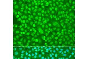 Immunofluorescence analysis of U2OS cells using PER1 Polyclonal Antibody at dilution of 1:100. (PER1 antibody)