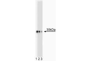 Western blot analysis of Acrp30 on plasma lysate. (ADIPOQ antibody  (AA 1-247))