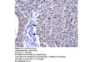 Human Heart (OTX2 antibody  (N-Term))
