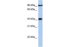 PTOV1 antibody used at 0. (PTOV1 antibody  (N-Term))