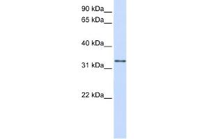 WB Suggested Anti-GPSN2 Antibody Titration:  0. (TECR antibody  (C-Term))