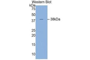 Western blot analysis of the recombinant protein. (Cardiac Troponin T2 antibody  (AA 1-295))