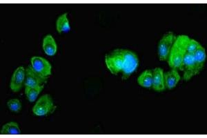 Immunofluorescent analysis of MCF-7 cells using ABIN7162466 at dilution of 1:100 and Alexa Fluor 488-congugated AffiniPure Goat Anti-Rabbit IgG(H+L) (PDRG1 antibody  (AA 1-133))