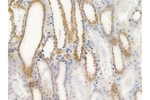 ABIN6263572 and ABIN6279582 at 1/100 staining human normal kidney tissue by IHC-P.