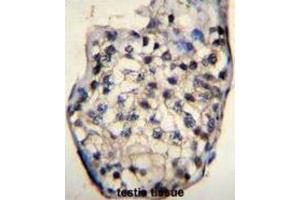 Immunohistochemistry (IHC) image for anti-Outer Dense Fiber of Sperm Tails 3 (ODF3) antibody (ABIN2996385)
