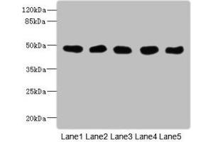 Western Blot All lanes: GCDH antibody at 8 μg/mL Lane 1: Mouse kidney tissue Lane 2: Mouse liver tissue Lane 3: Hela whole cell lysate Lane 4: MCF-7 whole cell lysate Lane 5: LO2 whole cell lysate Secondary Goat polyclonal to rabbit IgG at 1/10000 dilution Predicted band size: 49, 48 kDa Observed band size: 49 kDa (GCDH antibody  (AA 45-300))