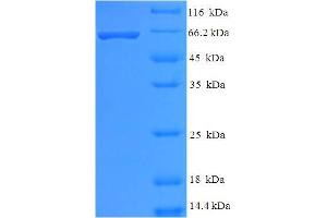 SDS-PAGE (SDS) image for Histone Deacetylase 8 (HDAC8) (AA 1-377), (full length) protein (His-SUMO Tag) (ABIN4975747) (HDAC8 Protein (AA 1-377, full length) (His-SUMO Tag))