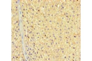 Immunohistochemistry of paraffin-embedded human adrenal gland tissue using ABIN7176291 at dilution of 1:100 (Zinc Finger Protein 44 antibody  (AA 1-300))