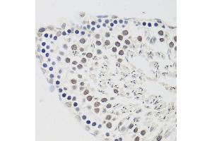 Immunohistochemistry of paraffin-embedded rat testis using Cyclin E2 antibody (ABIN1679046, ABIN3018761, ABIN3018762 and ABIN6220571) at dilution of 1:100 (40x lens). (Cyclin E2 antibody  (C-Term))