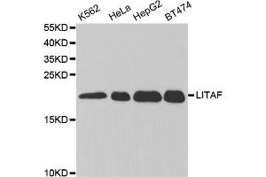 Western blot analysis of extracts of various cell lines, using LITAF antibody (ABIN5973182) at 1/1000 dilution. (LITAF antibody)