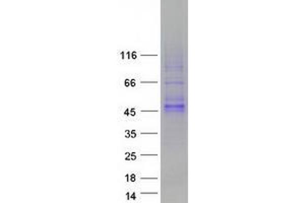 WNT16 Protein (Transcript Variant 1) (Myc-DYKDDDDK Tag)