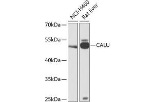 Western blot analysis of extracts of various cell lines, using CALU antibody (ABIN6129532, ABIN6137877, ABIN6137879 and ABIN6216027) at 1:1000 dilution. (CALU antibody  (AA 20-315))
