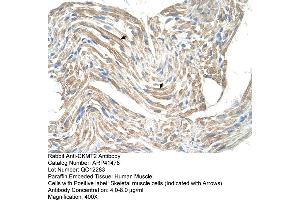Rabbit Anti-CKMT2 Antibody  Paraffin Embedded Tissue: Human Muscle Cellular Data: Skeletal muscle cells Antibody Concentration: 4. (CKMT2 antibody  (N-Term))