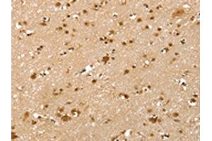 The image on the left is immunohistochemistry of paraffin-embedded Human brain tissue using ABIN7192547(SLTM Antibody) at dilution 1/40, on the right is treated with synthetic peptide. (SLTM antibody)