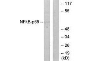 Western blot analysis of extracts from HeLa cells, using NF-kappaB p65 (Ab-536) Antibody. (NF-kB p65 antibody  (AA 502-551))