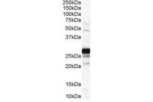 Image no. 1 for anti-Catechol-O-Methyltransferase (COMT) (Internal Region) antibody (ABIN374718) (COMT antibody  (Internal Region))