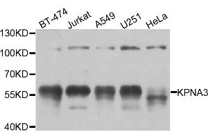Western blot analysis of extracts of various cell lines, using KPNA3 antibody (ABIN5974559) at 1/1000 dilution. (KPNA3 antibody)