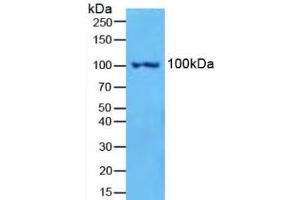 Detection of NFkB2 in Mouse Spleen Tissue using Polyclonal Antibody to Nuclear Factor Kappa B2 (NFkB2) (Nuclear Factor kappa B2 (AA 38-343) antibody)