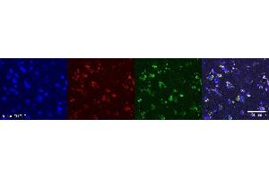 Immunohistochemistry (IHC) image for anti-Oligodendrocytic Myelin Paranodal and Inner Loop Protein (OPALIN) antibody (ABIN7456149) (OPALIN antibody)