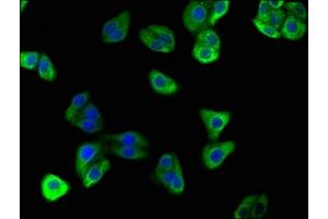 Immunofluorescence staining of HepG2 cells with ABIN7175242 at 1:166, counter-stained with DAPI. (ATP6VD2 (AA 50-295) antibody)