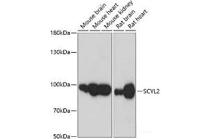 Western blot analysis of extracts of various cell lines using SCYL2 Polyclonal Antibody at dilution of 1:3000. (SCYL2 antibody)