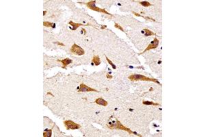 (ABIN6242448 and ABIN6578653) staining RPS27 in human brain tissue sections by Immunohistochemistry (IHC-P - paraformaldehyde-fixed, paraffin-embedded sections). (RPS27 antibody  (AA 5-37))