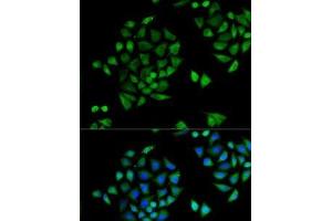 Immunofluorescence analysis of U2OS cells using CYP2C9 Polyclonal Antibody (CYP2C9 antibody)