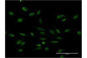 Immunofluorescence of monoclonal antibody to PMS2 on HeLa cell. (PMS2 antibody  (AA 763-862))