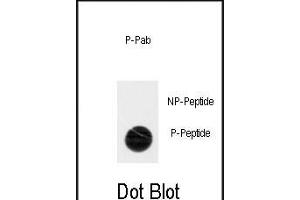 Dot blot analysis of anti-Phospho-ACK1-p Antibody (ABIN389970 and ABIN2839765) on nitrocellulose membrane. (TNK2 antibody  (pTyr518))